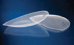  3D mesh for inguinal hernia